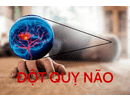 Hướng dẫn chẩn đoán và xử trí đột quỵ não năm 2024 của Bộ Y tế